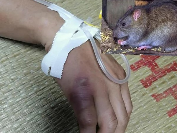 Nằm mơ thấy chuột cắn tay con gì chuẩn, là điềm gì?